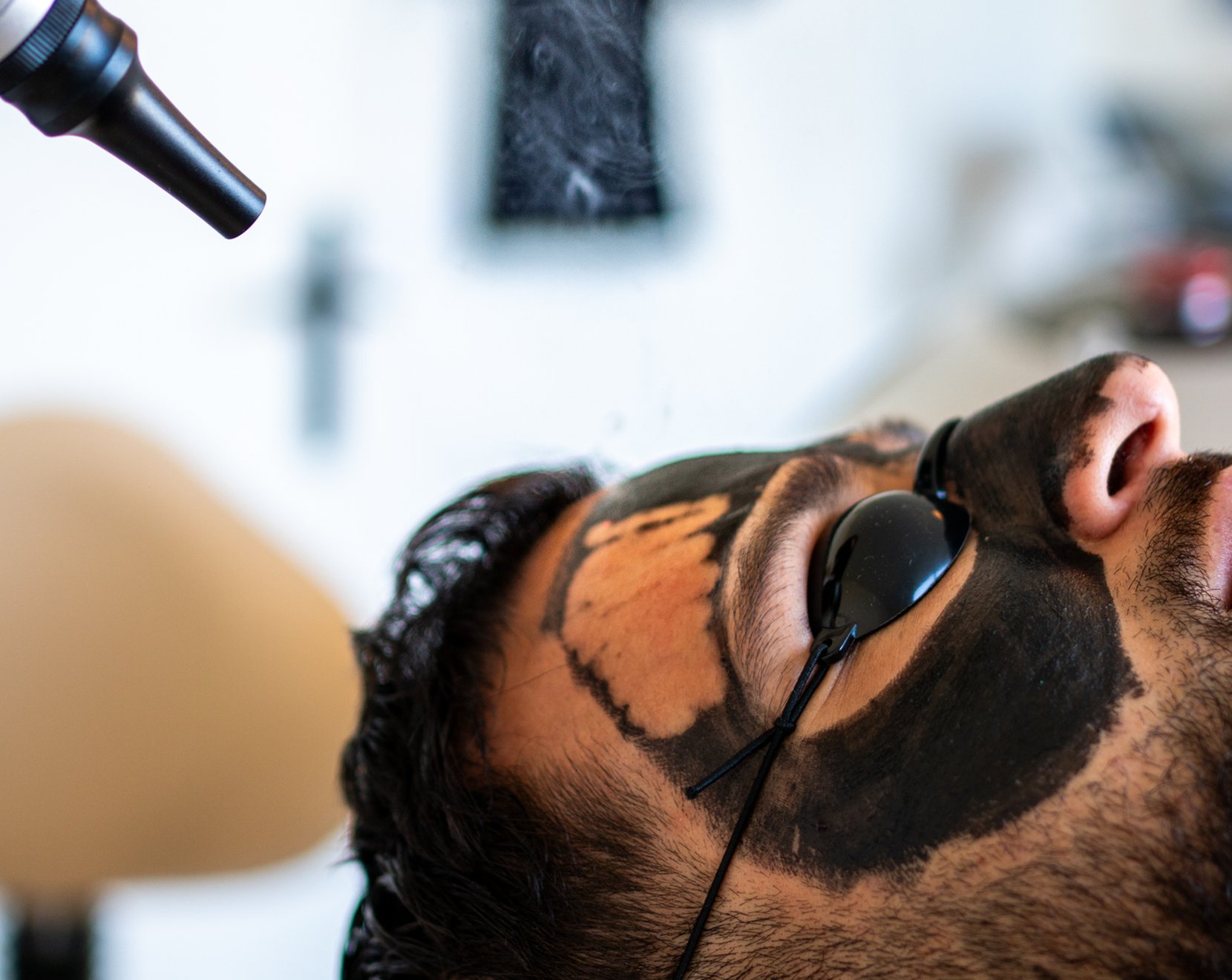 formation détatouage carbon peel