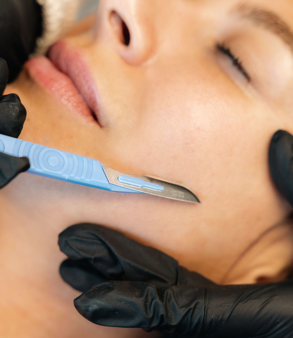 photo de la formation dermaplaning