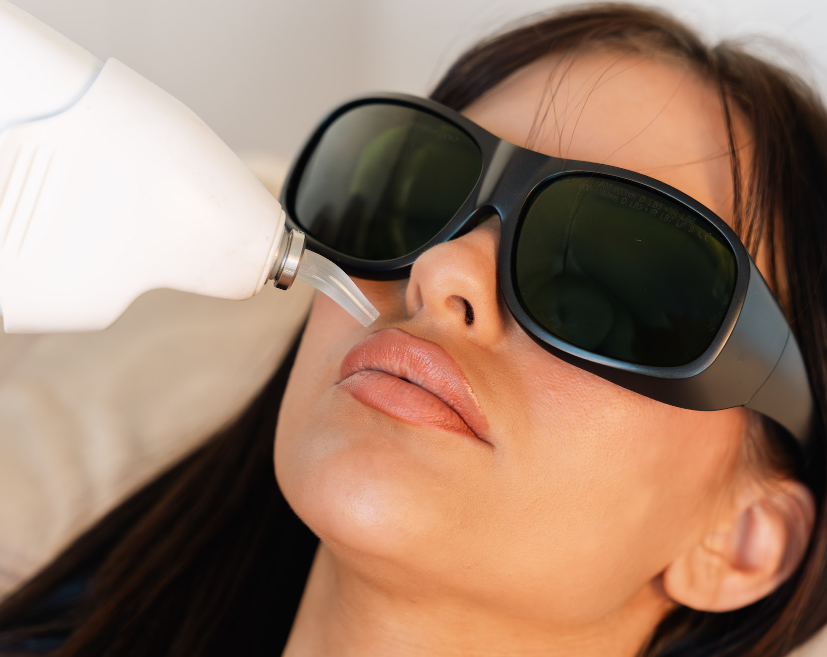 épilation laser visage femme