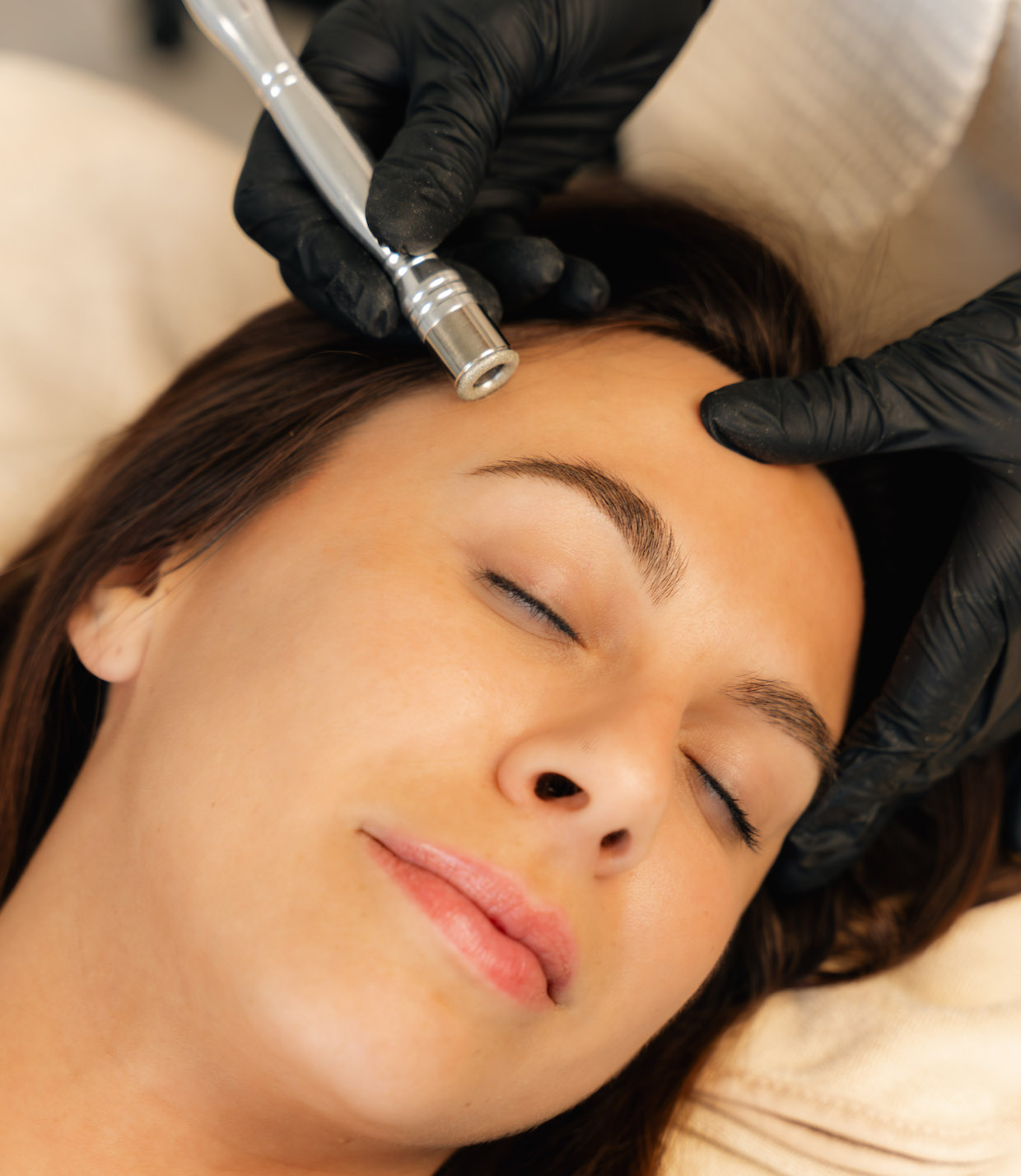 photo de la formation microneedling