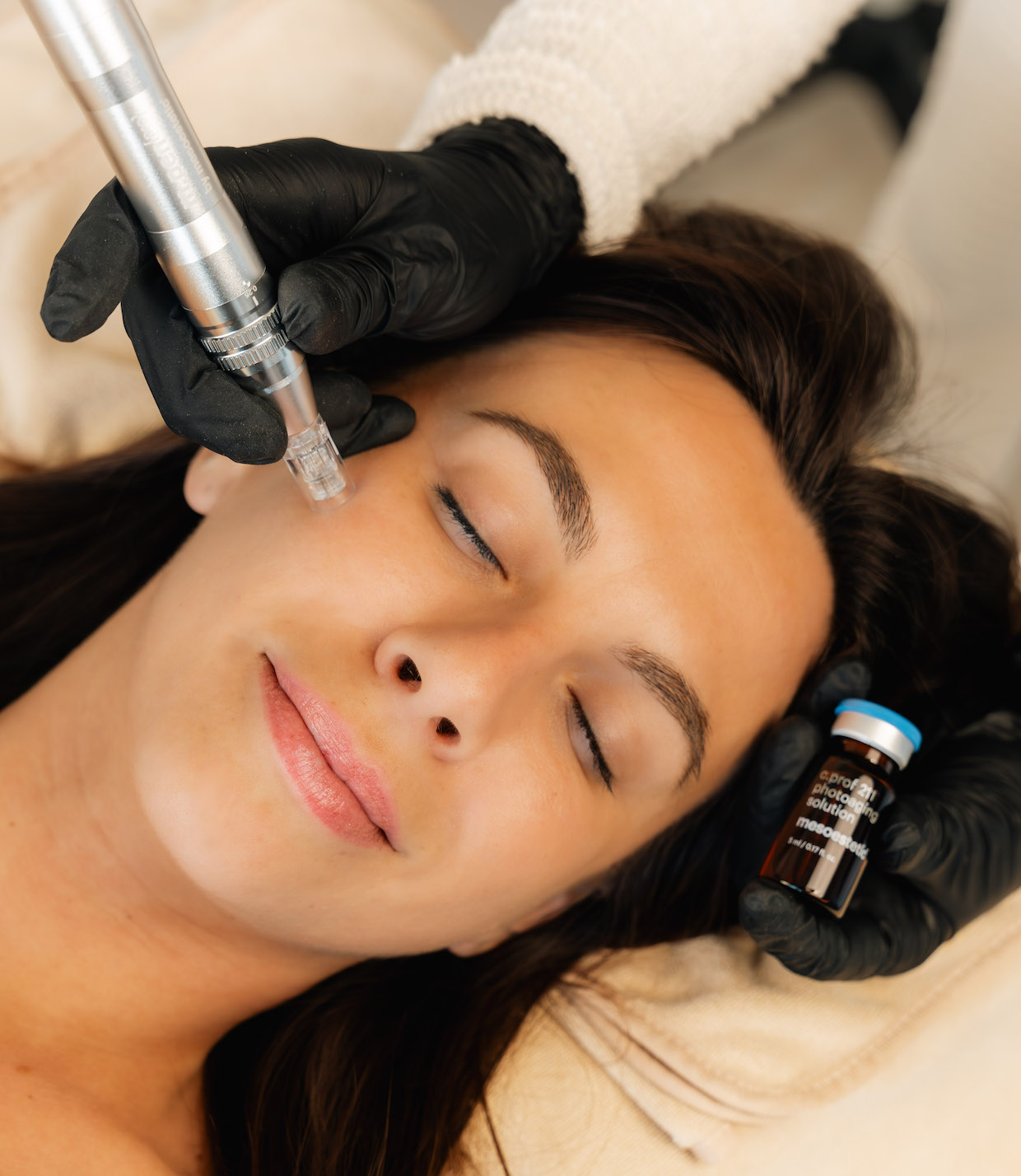 photo du soin en profondeur microneedling