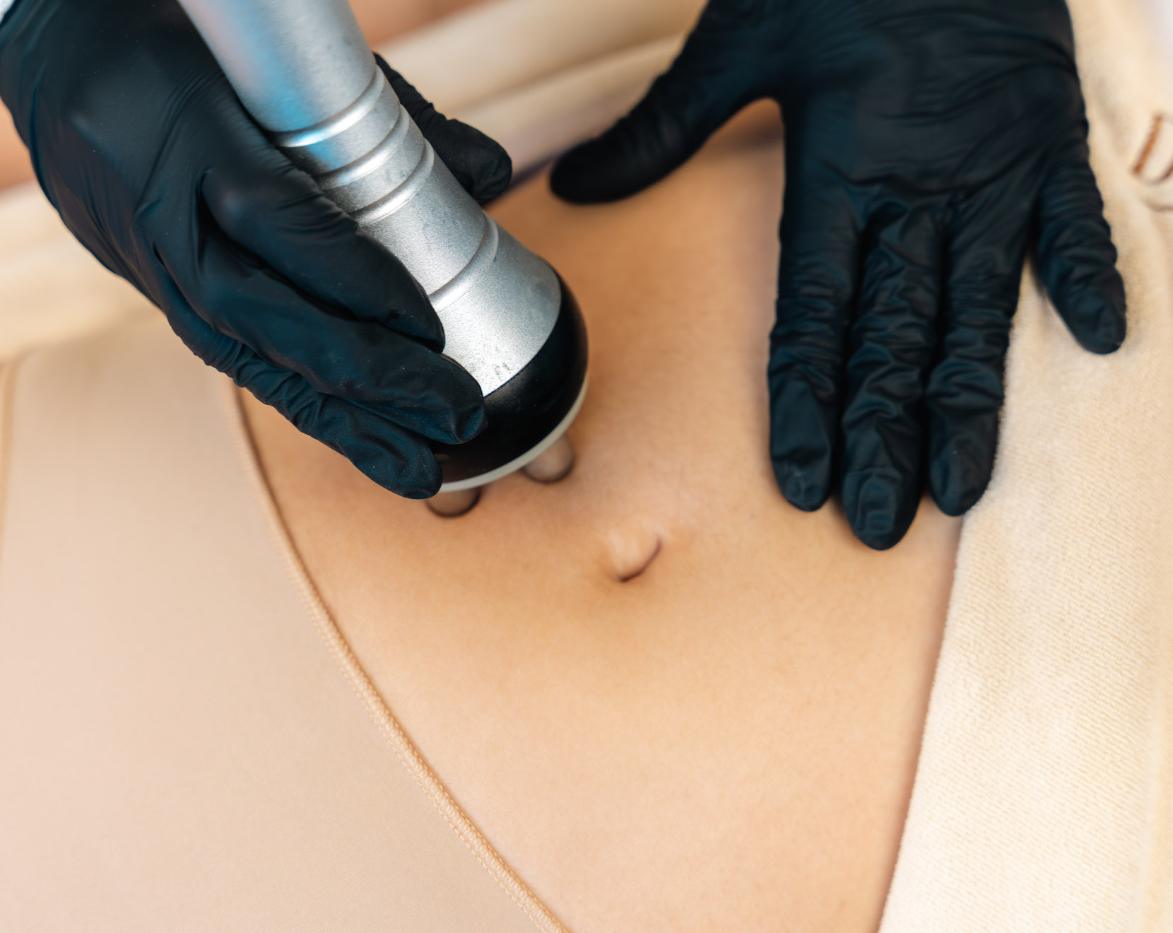 photo du soin radiofréquence lipocavitation