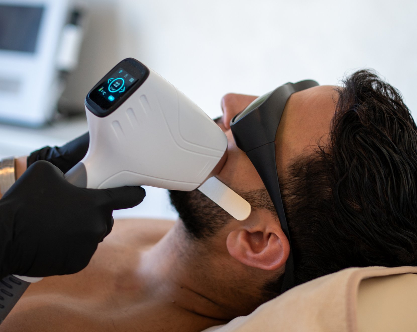 Photo du soin épilation laser visage homme