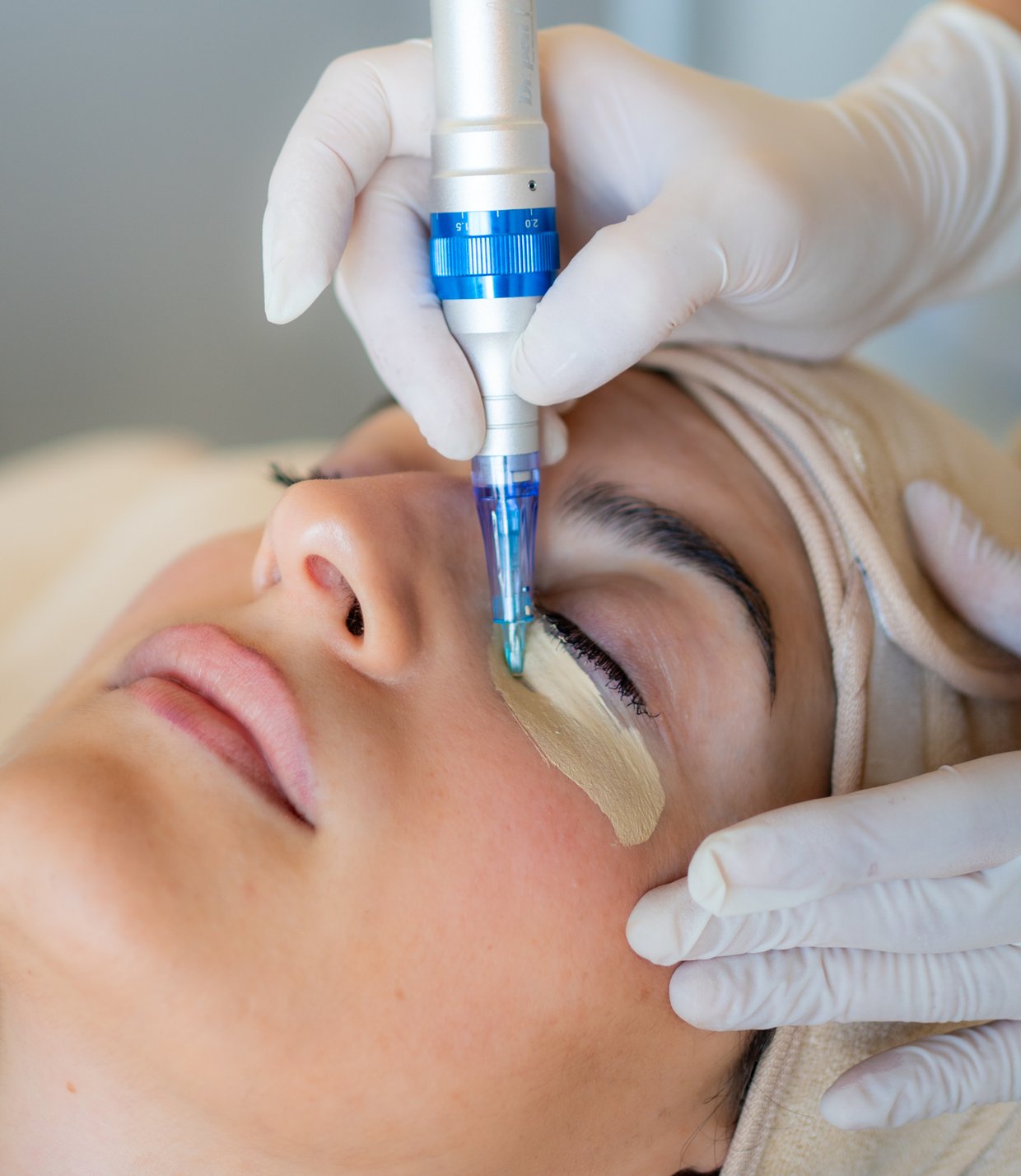 photo dermopigmentation des cernes